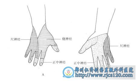 桡神经损伤的运动障碍是什么