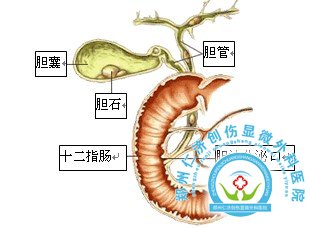 容易与胆囊炎混淆的疾病