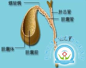 胆结石饮食的注意事项